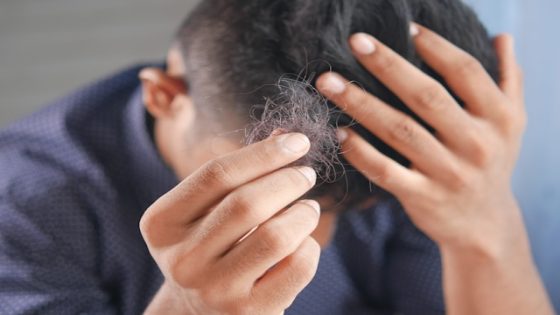 تفسير تساقط الشعر في الحلم رؤية شعري يسقط في المنام