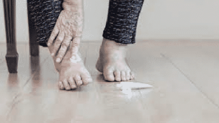 هل الغرغرينا معدية من شخص لآخر؟